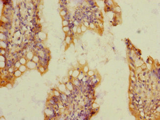 SOAT2 Antibody - Immunohistochemistry of paraffin-embedded human small intestine at dilution 1:100