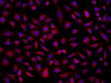 SOAT2 Antibody - Immunofluorescence staining of SOAT2 in Hela cells. Cells were fixed with 4% PFA, permeabilzed with 0.1% Triton X-100 in PBS, blocked with 10% serum, and incubated with rabbit anti-Human SOAT2 polyclonal antibody (dilution ratio 1:200) at 4°C overnight. Then cells were stained with the Alexa Fluor 594-conjugated Goat Anti-rabbit IgG secondary antibody (red) and counterstained with DAPI (blue). Positive staining was localized to Cytoplasm.