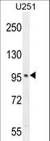 SOBP Antibody - SOBP Antibody western blot of U251 cell line lysates (35 ug/lane). The SOBP antibody detected the SOBP protein (arrow).