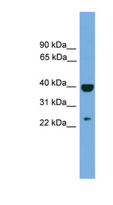 SOCS1 Antibody - SOCS1 antibody Western blot of ACHN lysate. This image was taken for the unconjugated form of this product. Other forms have not been tested.