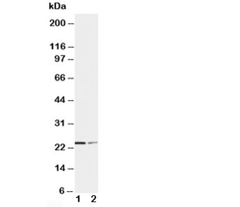 SOCS1 Antibody - Western blot testing of SOCS1 antibody and Lane 1: HT1080; 2: COLO320 cell lysate. Predicted molecular weight ~ 24 kDa.