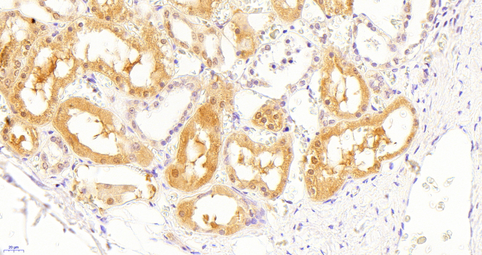 SOCS1 Antibody - SOCS1 Antibody (5µg/ml) staining of paraffin embedded Human Kidney. Heat induced antigen retrieval with citrate buffer pH 6, HRP-staining.