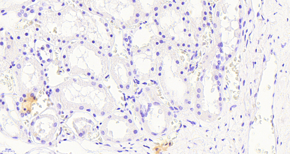 SOCS1 Antibody - SOCS1 Antibody Negative Control showing staining of paraffin embedded Human Kidney, with no primary antibody.