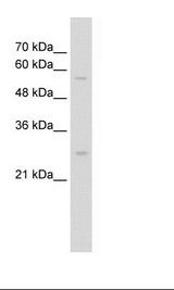SOCS1 Antibody - HepG2 Cell Lysate.  This image was taken for the unconjugated form of this product. Other forms have not been tested.