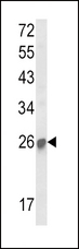 SOCS1 Antibody - Western blot of SOCS1 Antibody in mouse kidney tissue lysates (35 ug/lane). SOCS1 (arrow) was detected using the purified antibody.