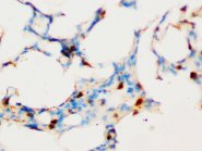 SOCS1 Antibody -  This image was taken for the unconjugated form of this product. Other forms have not been tested.