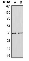 SOCS1 Antibody - Western blot analysis of SOCS1 expression in MCF7 (A); mouse kidney (B) whole cell lysates.