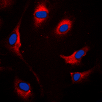SOCS1 Antibody - Immunofluorescent analysis of SOCS1 staining in MCF7 cells. Formalin-fixed cells were permeabilized with 0.1% Triton X-100 in TBS for 5-10 minutes and blocked with 3% BSA-PBS for 30 minutes at room temperature. Cells were probed with the primary antibody in 3% BSA-PBS and incubated overnight at 4 C in a humidified chamber. Cells were washed with PBST and incubated with a DyLight 594-conjugated secondary antibody (red) in PBS at room temperature in the dark. DAPI was used to stain the cell nuclei (blue).