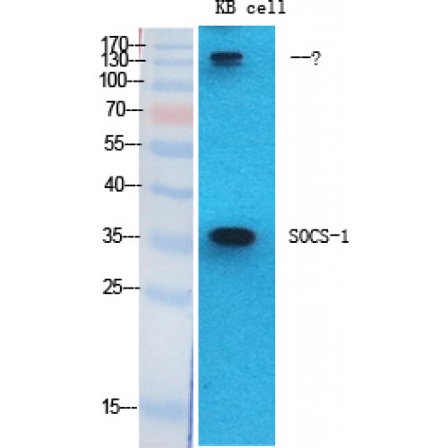 SOCS1 Antibody - Western blot of SOCS-1 antibody