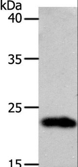 SOCS1 Antibody - Western blot analysis of 231 cell, using SOCS1 Polyclonal Antibody at dilution of 1:1300.