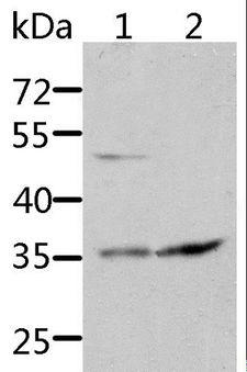 SOCS1 Antibody - Western blot analysis of HT-29 and 231 cell, using SOCS1 Polyclonal Antibody at dilution of 1:1700.