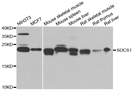 SOCS1 Antibody - Western blot analysis of extracts of various cell lines.