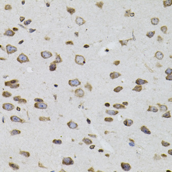 SOCS1 Antibody - Immunohistochemistry of paraffin-embedded mouse brain tissue.