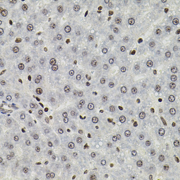 SOCS1 Antibody - Immunohistochemistry of paraffin-embedded rat liver tissue.