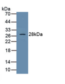 SOCS1 Antibody - Western Blot Sample: Recombinant SOCS1, Human
