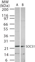 SOCS1 Antibody - Western blot of SOCS1 using antibody at 1:1000 dilution against 15 ug/lane of Ramos (A) and Raw (B) cell lysate.