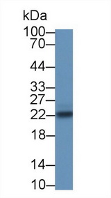 SOCS2 Antibody - Western Blot; Sample: Rat Liver lysate; Primary Ab: 1µg/ml Rabbit Anti-Rat SOCS2 Antibody Second Ab: 0.2µg/mL HRP-Linked Caprine Anti-Rabbit IgG Polyclonal Antibody