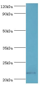 SOCS2 Antibody - Western blot. All lanes: Suppressor of cytokine signaling 2 antibody at 2 ug/ml+HepG2 whole cell lysate. Secondary antibody: Goat polyclonal to rabbit at 1:10000 dilution. Predicted band size: 22 kDa. Observed band size: 22 kDa Immunohistochemistry.