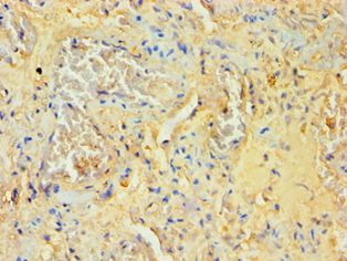 SOCS2 Antibody - Immunohistochemistry of paraffin-embedded human lung using antibody at 1:100 dilution.