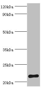 SOCS2 Antibody - Western blot All lanes: Suppressor of cytokine signaling 2 antibody at 2µg/ml + HepG2 whole cell lysate Secondary Goat polyclonal to rabbit IgG at 1/10000 dilution Predicted band size: 22 kDa Observed band size: 22 kDa