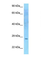 SOCS2 Antibody - SOCS2 antibody Western blot of U937 Cell lysate. Antibody concentration 1 ug/ml.  This image was taken for the unconjugated form of this product. Other forms have not been tested.