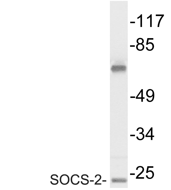 SOCS2 Antibody - Western blot analysis of lysate from Jurkat cells, using SOCS-2 antibody.