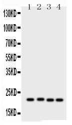 SOCS2 Antibody - antibody, PB, Western blot. All lanes: Anti SOCS2 at 0.5 ug/ml. Lane 1: PC-12 Whole Cell Lysate at 40 ug. Lane 2: SW620 Whole Cell Lysate at 40 ug. Lane 3: HELA Whole Cell Lysate at 40 ug. Lane 4: MCF-7 Whole Cell Lysate at 40 ug. Predicted band size: 22 kD. Observed band size: 22 kD.