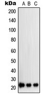SOCS2 Antibody - Western blot analysis of SOCS2 expression in K562 (A); A204 (B); PC12 (C) whole cell lysates.
