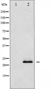 SOCS2 Antibody - Western blot analysis SOCS2 using COS7 whole cells lysates