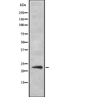 SOCS2 Antibody - Western blot analysis of SOCS2 antibody expression in HeLa cells lysates.