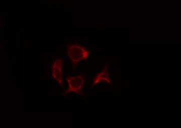 SOCS2 Antibody - Staining 293T cells by IF/ICC. The samples were fixed with PFA and permeabilized in 0.1% Triton X-100, then blocked in 10% serum for 45 min at 25°C. The primary antibody was diluted at 1:200 and incubated with the sample for 1 hour at 37°C. An Alexa Fluor 594 conjugated goat anti-rabbit IgG (H+L) Ab, diluted at 1/600, was used as the secondary antibody.