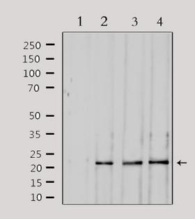 SOCS2 Antibody - Western blot analysis of extracts of various samples using SOCS2 antibody. Lane 1: 293 treated with blocking peptide; Lane 2: 293; Lane 3: mouse brain; Lane 4: HeLa;