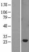SOCS2 Protein - Western validation with an anti-DDK antibody * L: Control HEK293 lysate R: Over-expression lysate