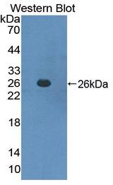 SOCS3 Antibody - Western Blot; Sample: Recombinant protein.