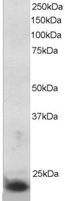 SOCS3 Antibody - Antibody staining (5 ug/ml) of MOLT-4 lysate (RIPA buffer, 30 ug total protein per lane). Primary incubated for 1 hour. Detected by Western blot of chemiluminescence.