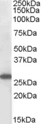 SOCS3 Antibody - SOCS3 antibody (1µg/ml) staining of MOLT4 lysate (35µg protein in RIPA buffer). Detected by chemiluminescence.