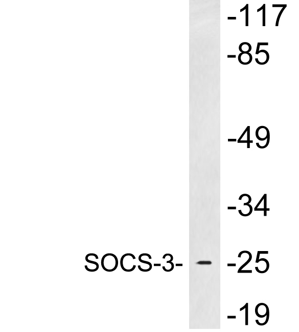 SOCS3 Antibody - Western blot analysis of lysates from heart tissue, using SOCS-3 antibody.