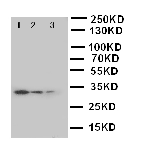 SOCS3 Antibody - WB of SOCS3 antibody. Lane 1: JURKAT Cell Lysate. Lane 2: CEM Cell Lysate. Lane 3: RAJI Cell Lysate.