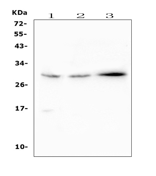SOCS3 Antibody - Western blot analysis of SOCS3 using anti-SOCS3 antibody. Electrophoresis was performed on a 5-20% SDS-PAGE gel at 70V (Stacking gel) / 90V (Resolving gel) for 2-3 hours. The sample well of each lane was loaded with 50ug of sample under reducing conditions. Lane 1: human Hela whole cell lysates, Lane 2: human A549 whole cell lysates, Lane 3: human A431 whole cell lysates. After Electrophoresis, proteins were transferred to a Nitrocellulose membrane at 150mA for 50-90 minutes. Blocked the membrane with 5% Non-fat Milk/ TBS for 1.5 hour at RT. The membrane was incubated with rabbit anti-SOCS3 antigen affinity purified polyclonal antibody at 0.5 µg/mL overnight at 4°C, then washed with TBS-0.1% Tween 3 times with 5 minutes each and probed with a goat anti-rabbit IgG-HRP secondary antibody at a dilution of 1:10000 for 1.5 hour at RT. The signal is developed using an Enhanced Chemiluminescent detection (ECL) kit with Tanon 5200 system. A specific band was detected for SOCS3 at approximately 30KD. The expected band size for SOCS3 is at 25KD.
