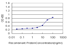 SOCS3 Antibody - Detection limit for recombinant GST tagged SOCS3 is approximately 3 ng/ml as a capture antibody.