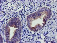 SOCS3 Antibody - IHC of paraffin-embedded Human endometrium tissue using anti-SOCS3 mouse monoclonal antibody.