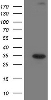 SOCS3 Antibody - HEK293T cells were transfected with the pCMV6-ENTRY control (Left lane) or pCMV6-ENTRY SOCS3 (Right lane) cDNA for 48 hrs and lysed. Equivalent amounts of cell lysates (5 ug per lane) were separated by SDS-PAGE and immunoblotted with anti-SOCS3.