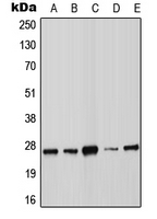 SOCS3 Antibody - Western blot analysis of SOCS3 expression in MOLT4 (A); A431 (B); MCF7 (C); Raw264.7 (D); H9C2 (E) whole cell lysates.