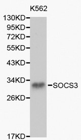 SOCS3 Antibody - Western blot of SOCS3 pAb in extracts from K562 cells.