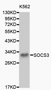SOCS3 Antibody - Western blot analysis of K562 cell lysate using SOCS3 antibody.