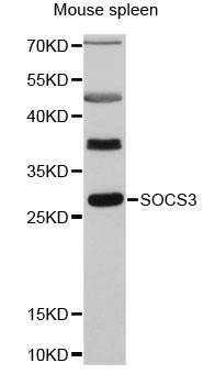 SOCS3 Antibody - Western blot analysis of extracts of mouse spleen, using SOCS3 antibody at 1:3000 dilution. The secondary antibody used was an HRP Goat Anti-Rabbit IgG (H+L) at 1:10000 dilution. Lysates were loaded 25ug per lane and 3% nonfat dry milk in TBST was used for blocking. An ECL Kit was used for detection and the exposure time was 30s.