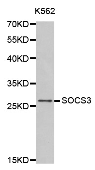 SOCS3 Antibody - Western blot analysis of extracts of K562 cells tissue, using SOCS3 antibody.