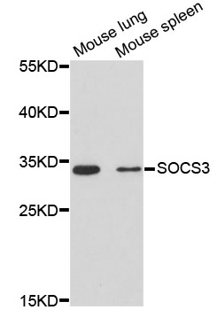 SOCS3 Antibody - Western blot analysis of extracts of various cell lines, using SOCS3 antibody at 1:3000 dilution. The secondary antibody used was an HRP Goat Anti-Rabbit IgG (H+L) at 1:10000 dilution. Lysates were loaded 25ug per lane and 3% nonfat dry milk in TBST was used for blocking. An ECL Kit was used for detection and the exposure time was 90s.