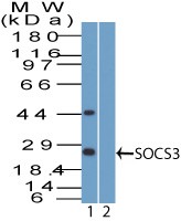 SOCS3 Antibody - Western Blot: SOCS3 Antibody - analysis of SOCS3. Jurkat lysate in the 1) absence and 2) presence of immunizing peptide probed with 4 ug/ml of SOCS3 antibody. I goat anti-rabbit Ig HRP secondary antibody and PicoTect ECL substrate solution were used for this test.