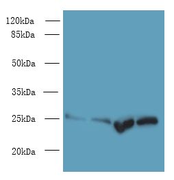 SOCS3 Antibody - Western blot. All lanes: Socs3 antibody at 12 ug/ml. Lane 1: K562 whole cell lysate. Lane 2: A375 whole cell lysate. Lane 3: HeLa whole cell lysate. Lane 4: HepG-2 whole cell lysate. Secondary antibody: Goat polyclonal to Rabbit IgG at 1:10000 dilution. Predicted band size: 25 kDa. Observed band size: 25 kDa.